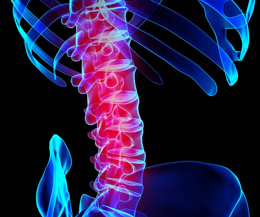 Xlif Procedure Golden State Orthopedics Spine