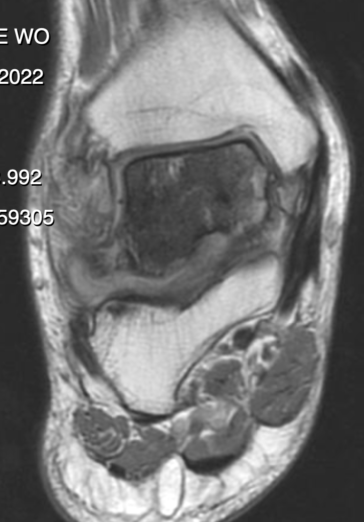 A black and white image of a knee with the year 2022 on the bottom